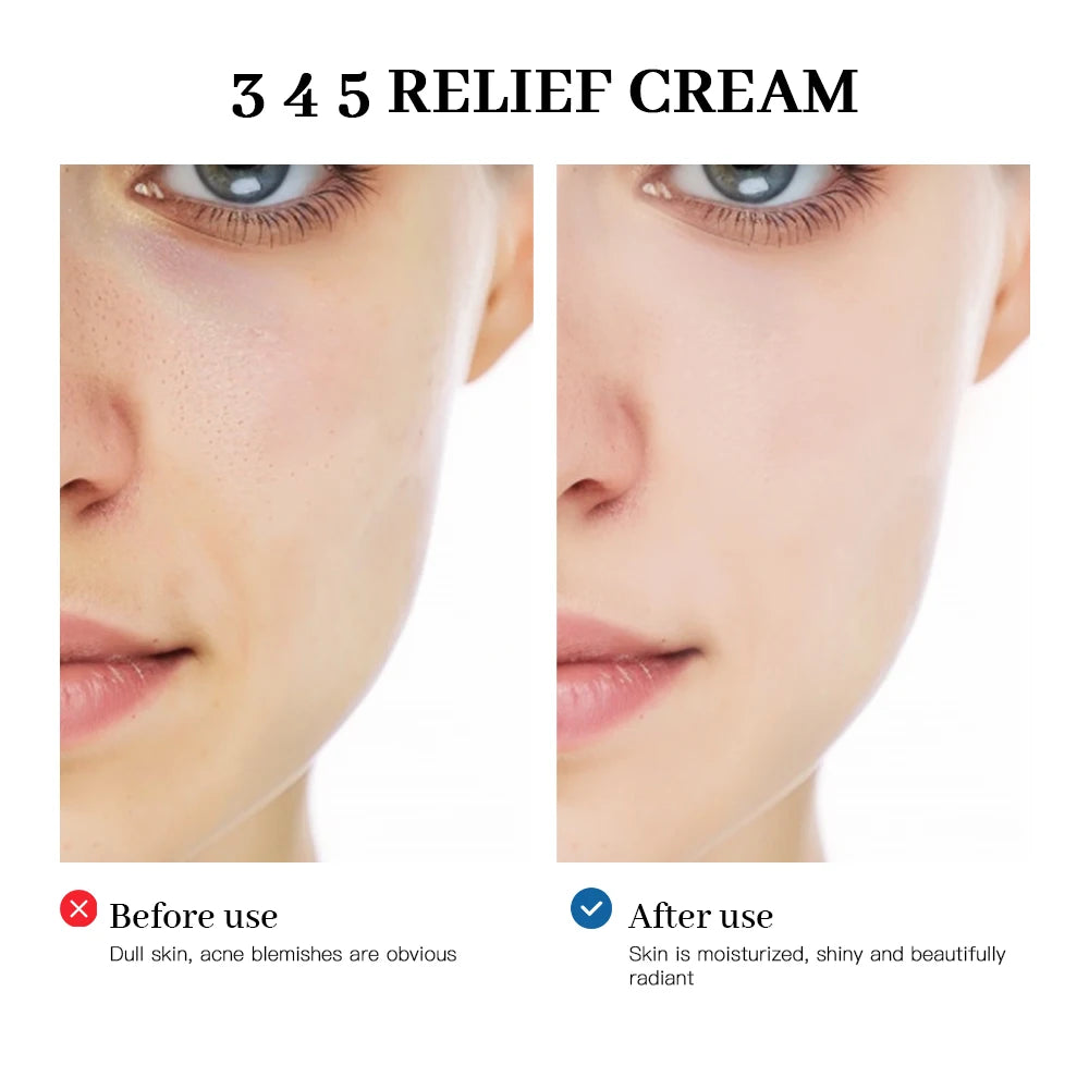 345 Relief Cream Address Blemishes Nourish the Skin and Provide Soothing Care Resulting in a Well-Rounded Skincare Solution