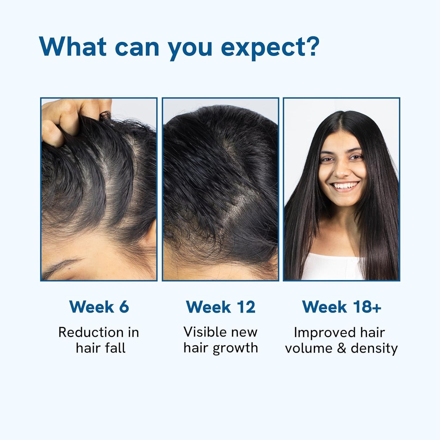 Be Bodywise Rosemary Hair Growth Serum (Roll On) | 3% Redensyl & 2% Anagain | Hair Fall Control Serum for Women & Men | Promotes Hair Growth & Stimulates Hair Follicles | for All Hair Types | 25Ml
